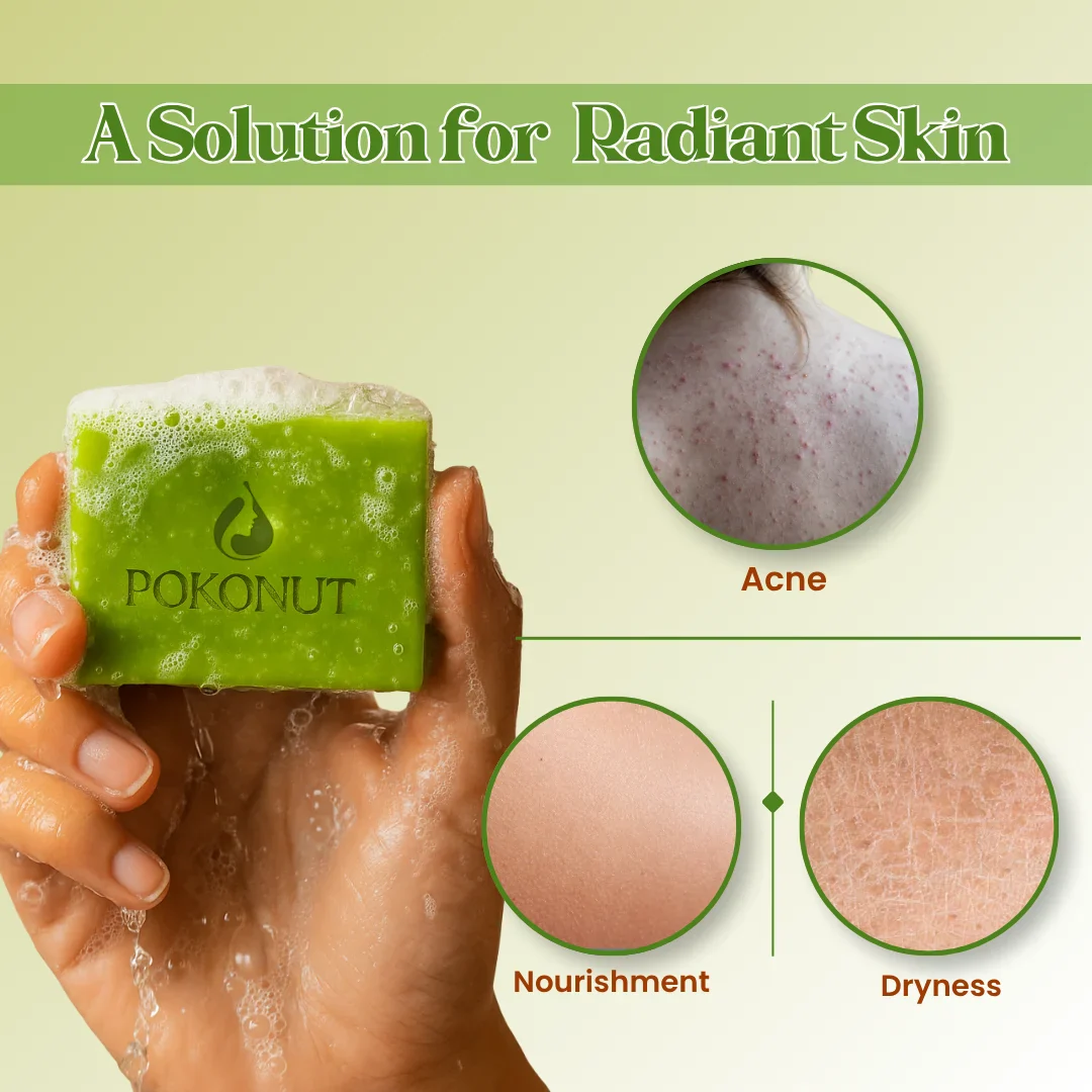 Anti acne soap -100g - Image 4