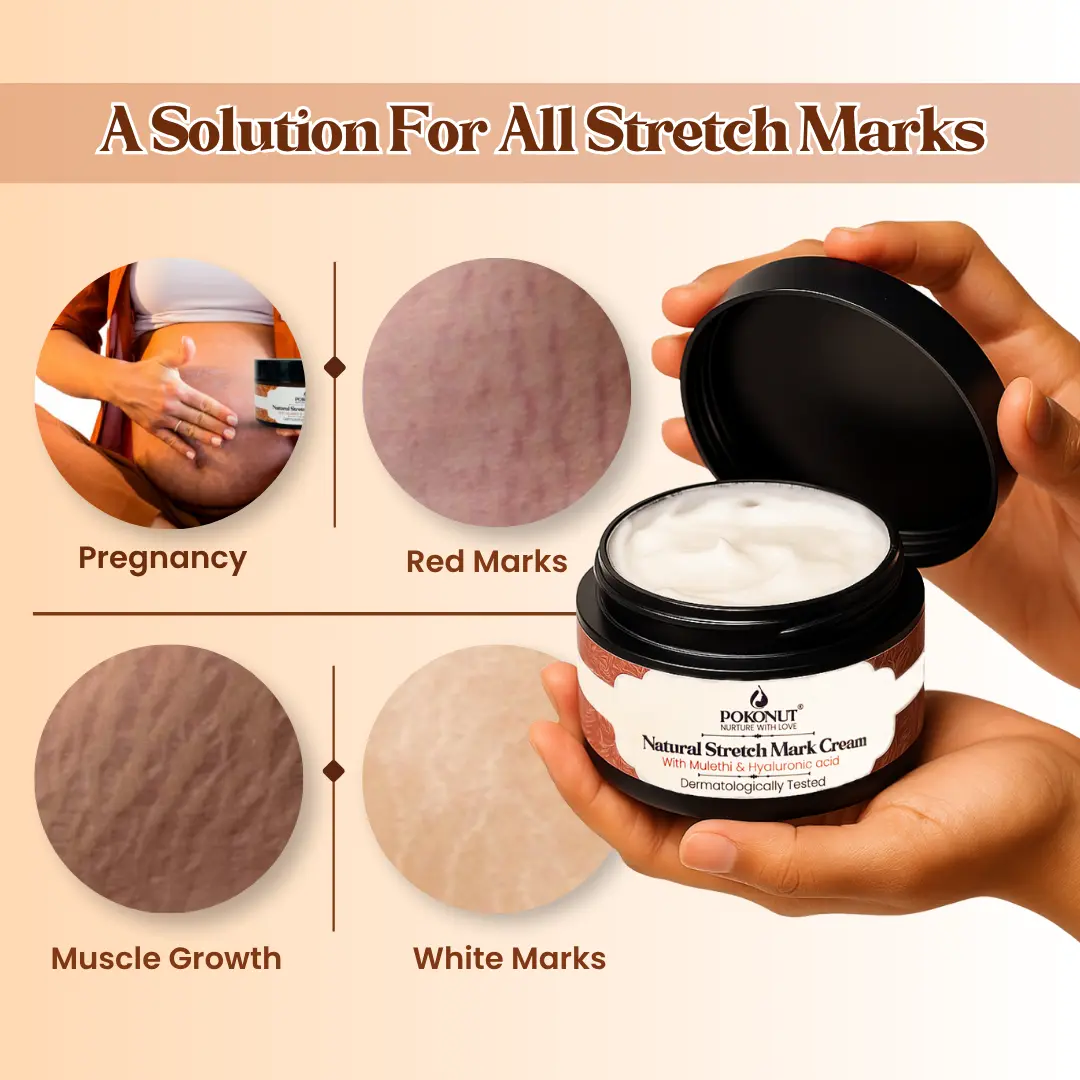 Skin Transition Care Duo | Stretch Mark and Melasma Repair - Image 4