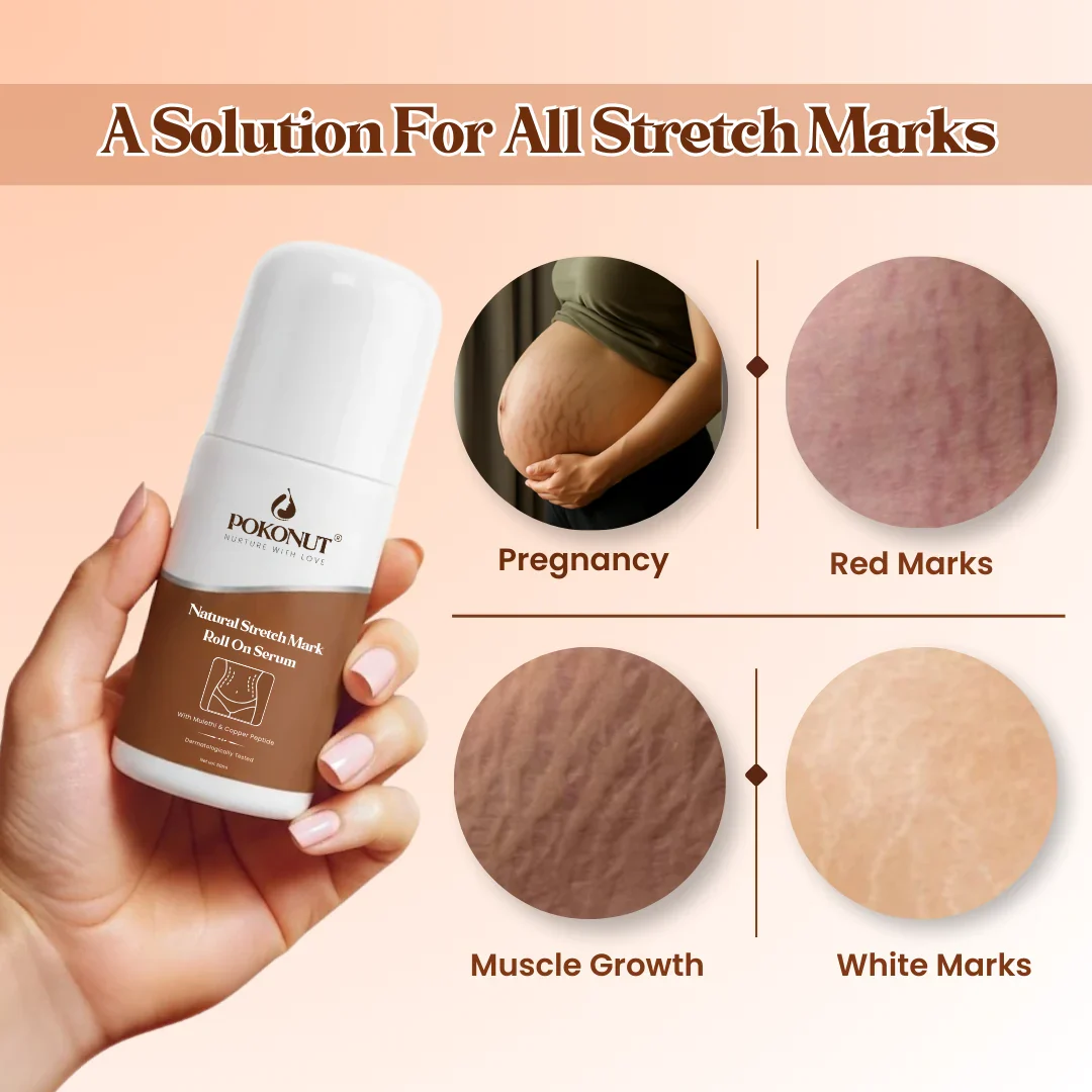 Stretch Mark Roll On - Image 4